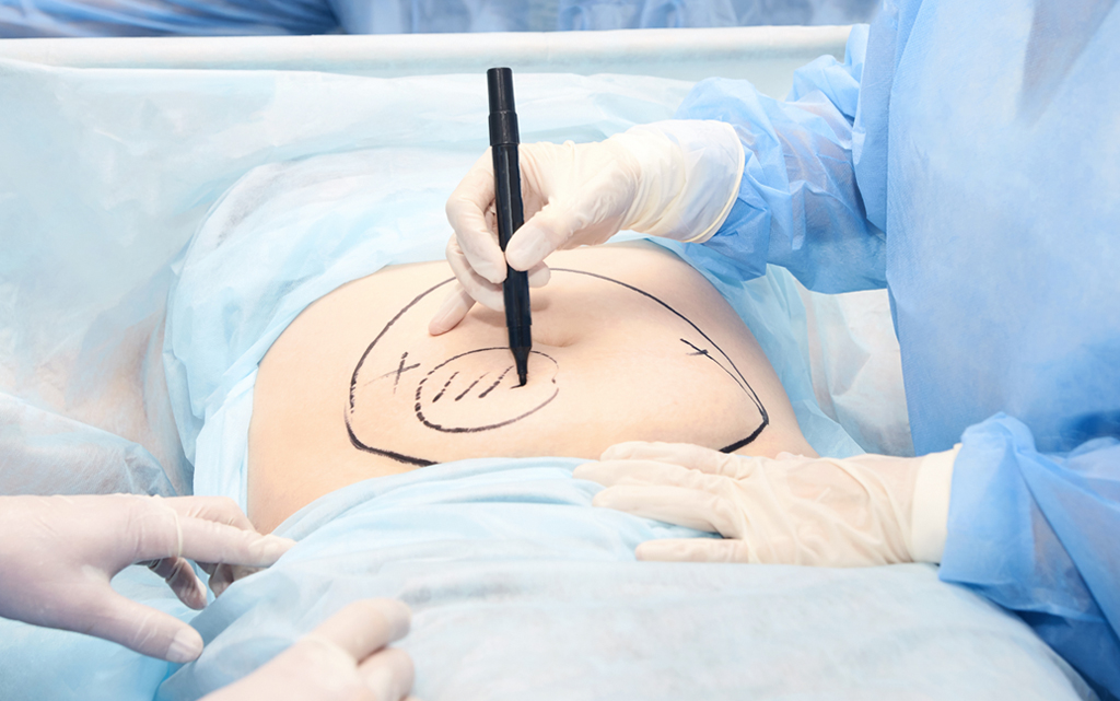 Future of Surgical Technology