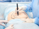 Future of Surgical Technology