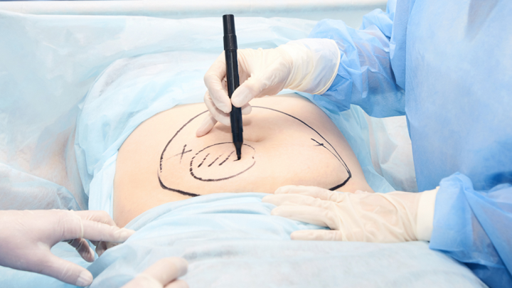 Future of Surgical Technology